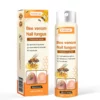 FLYCARE™ Bee Venom Nail Fungus Spray