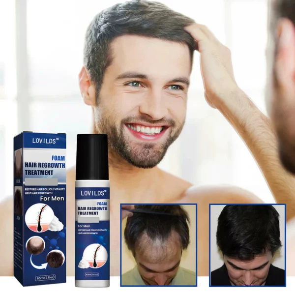 Lovilds™ Hair Growth Foam